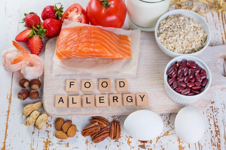 How Parents Can Help Their Kids With Food Allergies